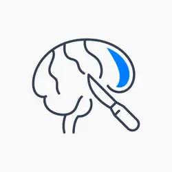 جراحی مغز و اعصاب