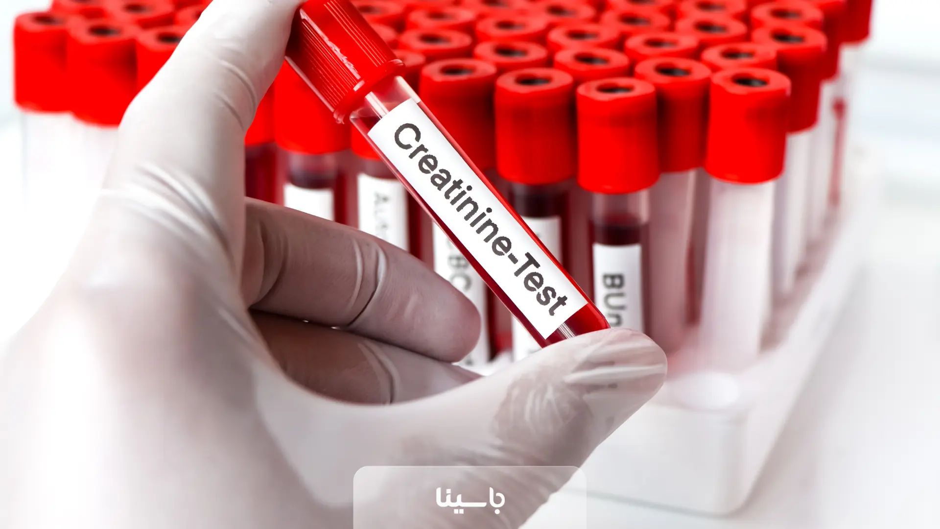 کراتینین بالا نشانه چیست؟